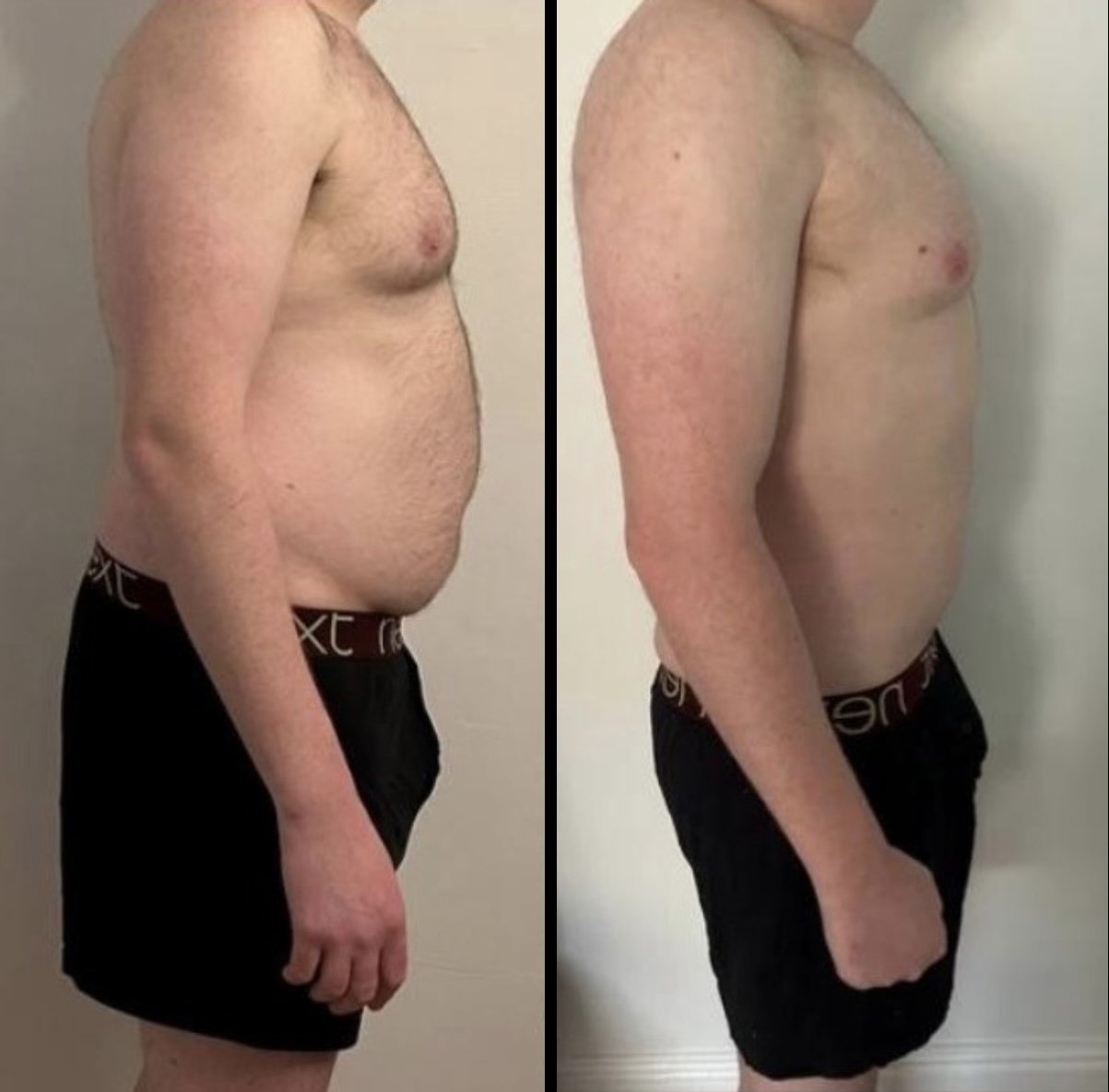 before-after